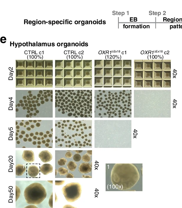 Plot showing: Microscopy, Brain Organoids, Schematic Illustration