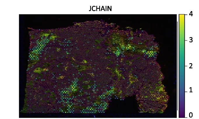 Plot showing: Heatmap, JCHAIN, Spatial Variable Genes, FF Endometrial Adenocarcinoma Ovarian Tissue, Visium