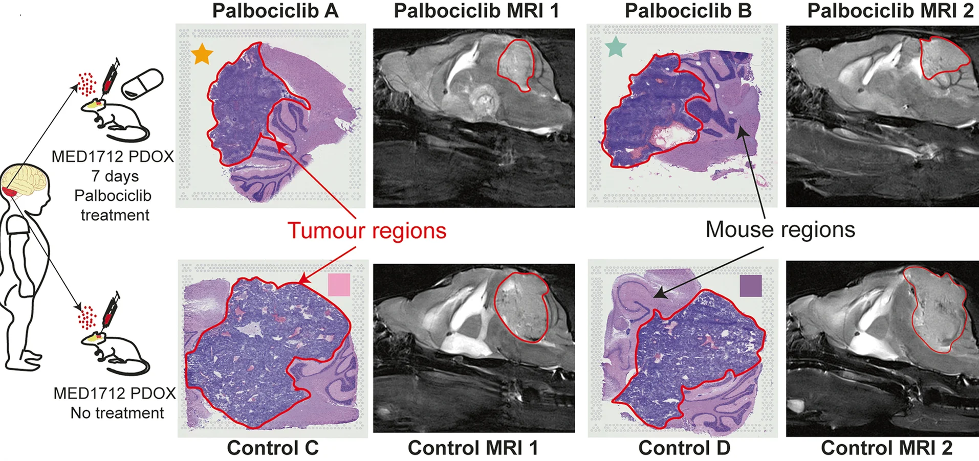 Plot showing: Microscopy, Photo, Experimental Design, Sonic Hedgehog, Medulloblastoma