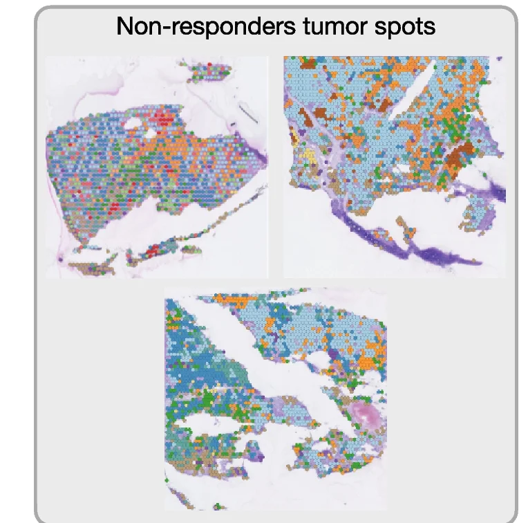 Plot showing: Microscopy, Differential Expression Analysis, Tumor Clusters, Responders, Non-responders