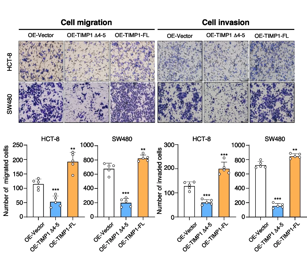 Plot showing: Bar Plot, Error Bars, Microscopy, Tumor Cell Migration, Invasion Assay