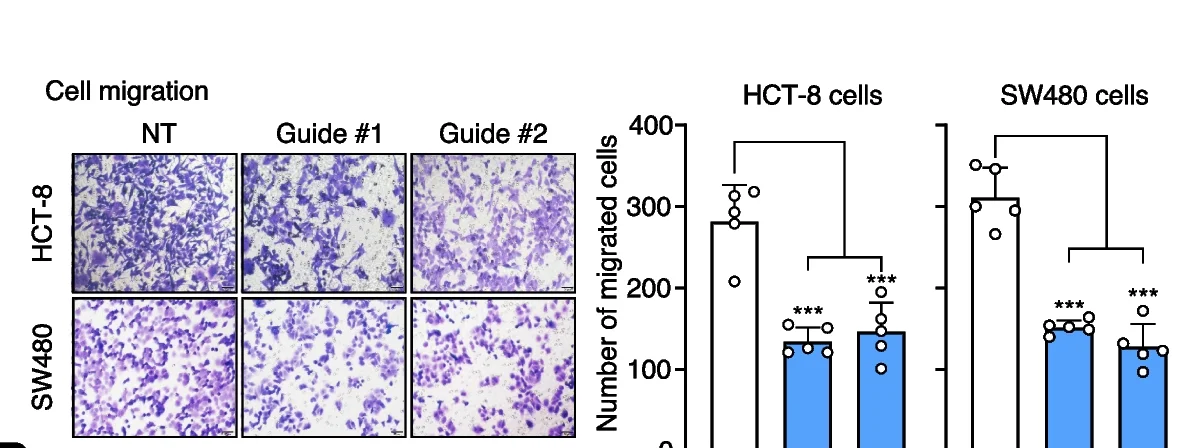 Plot showing: Bar Plot, Error Bars, Microscopy, Tumor Cell Migration, HCT-8 Cells