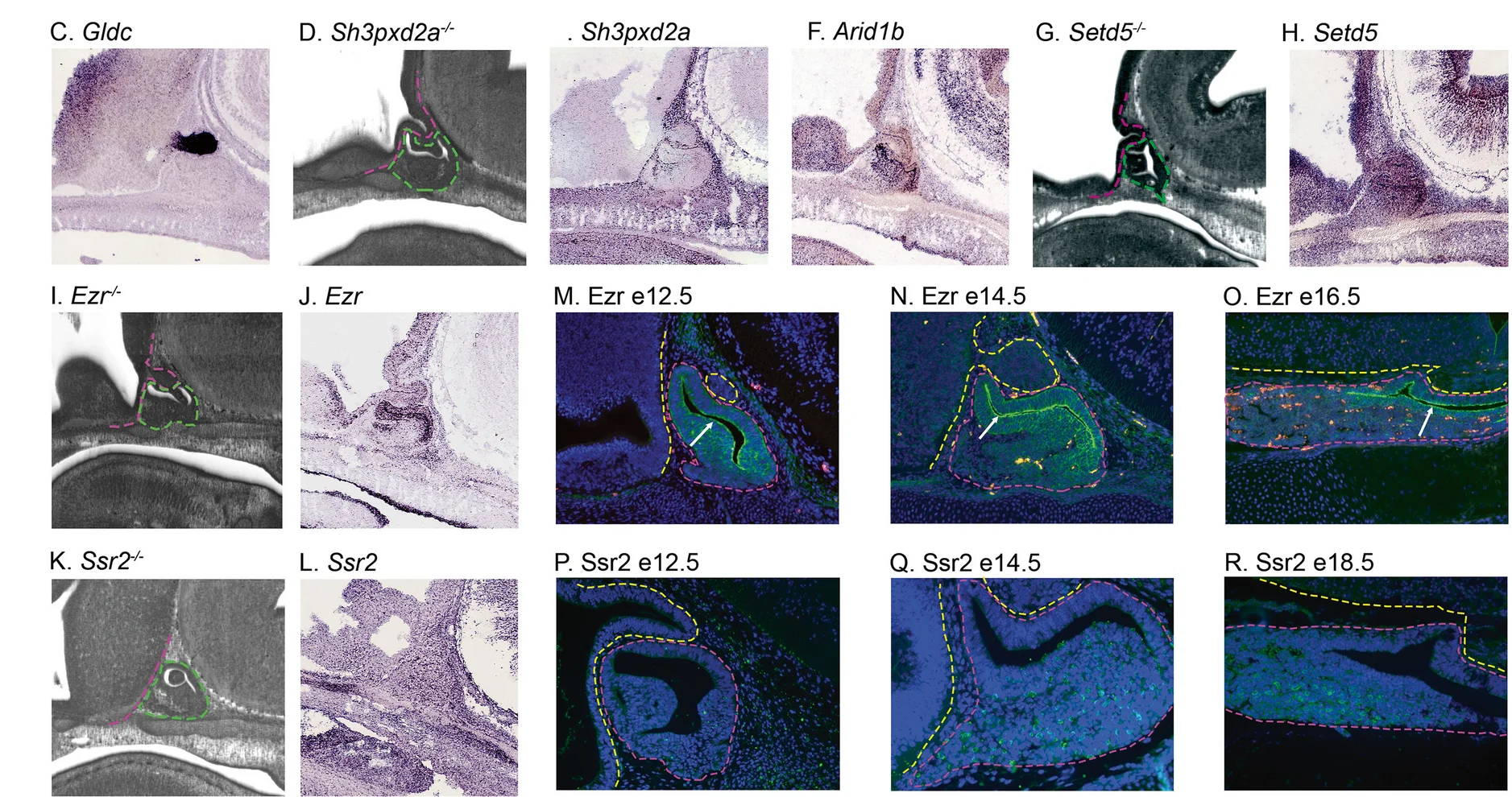 Plot showing: Microscopy, GenePaint, RNA in situ Hybridization, Sh3pxd2a
