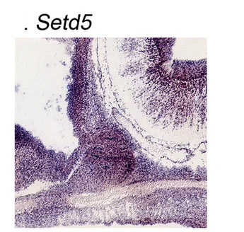 Plot showing: Microscopy, GenePaint, RNA in situ Hybridization, Setd5