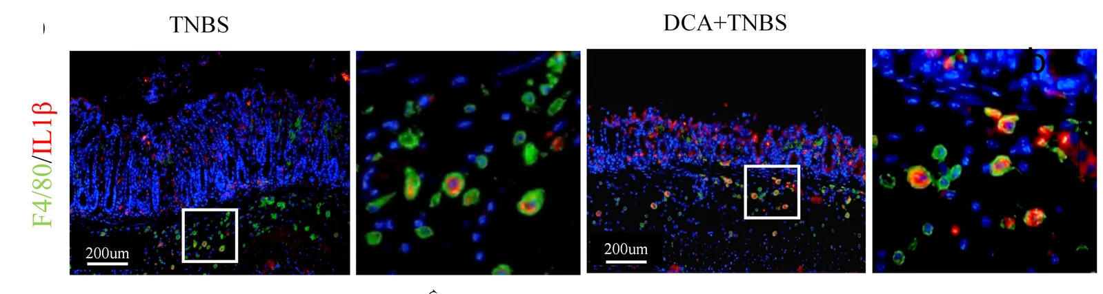 Plot showing: Microscopy, Immunofluorescence, Colon Tissues, F4/80, IL-1β